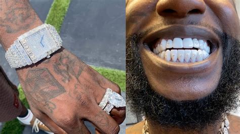 does gucci mane have fake teeth|Gucci Mane Spends $250K on New Teeth .